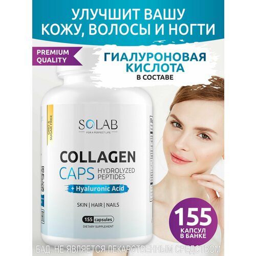   SOLAB          155    -     -,    